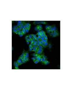 Cell Signaling Notch1 (D6f11) Xp Rabbit mAb