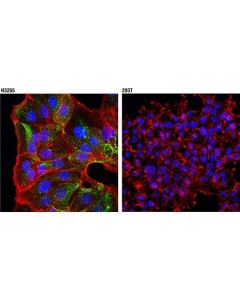 Cell Signaling Napsin A (D2g1y) Rabbit mAb (If Formulated)