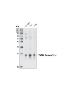 Cell Signaling Tweak Receptor/Fn14 Antibody