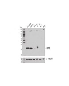Cell Signaling Lcn2 (D4m8l) Rabbit mAb