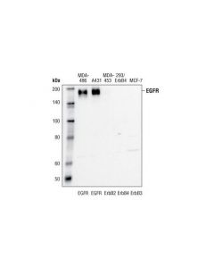 Cell Signaling Egf Receptor (15f8) Rabbit mAb