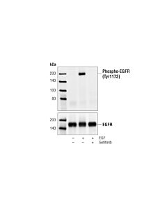 Cell Signaling Phospho-EGF Receptor (Tyr1173) (53A5) Rabbit mAb