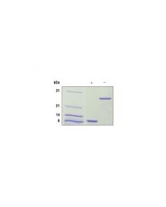Cell Signaling Human Il-5 Recombinant Protein