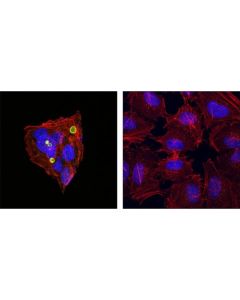 Cell Signaling Mrp2/Abcc2 (R260) Antibody