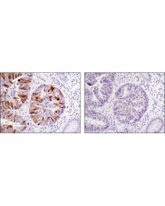 Cell Signaling Plk1 (208g4) Rabbit mAb
