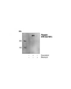 Cell Signaling Phospho-Atm (Ser1981) (10h11.E12) Mouse mAb