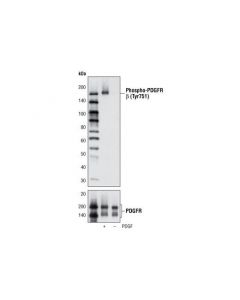 Cell Signaling Phospho-Pdgf Receptor Beta (Tyr751) (C63g6) Rabbit mAb
