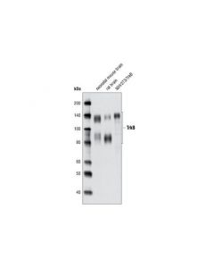 Cell Signaling Trkb (80e3) Rabbit mAb