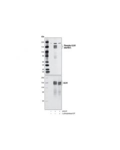 Cell Signaling Phospho-Ulk1 (Ser467) Antibody