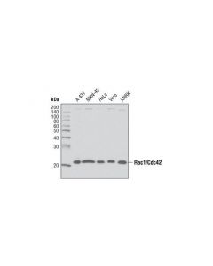 Cell Signaling Rac1/Cdc42 Antibody