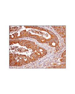 Cell Signaling Vdac (D73d12) Rabbit mAb