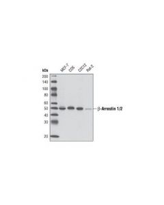 Cell Signaling Beta-Arrestin 1/2 (D24h9) Rabbit mAb