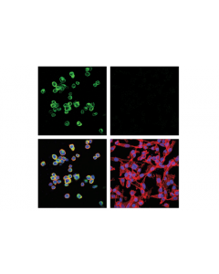 Cell Signaling Ykl-40 (E2l1m) Rabbit mAb