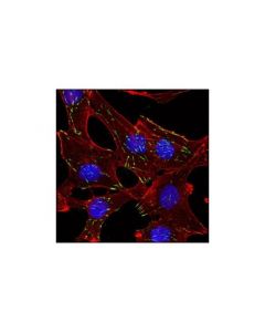 Cell Signaling Integrin Beta5 Antibody
