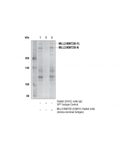 Cell Signaling Mll2/Kmt2b (E3m1v) Rabbit mAb (Amino-Terminal Antigen)