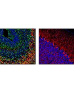Cell Signaling Nestin (Rat-401) Mouse mAb