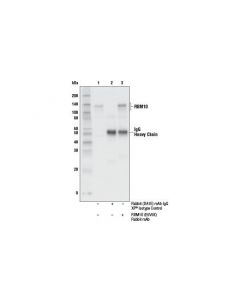 Cell Signaling Rbm10 (E5v5k) Rabbit mAb