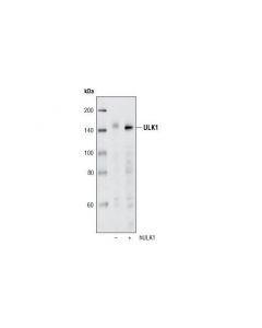 Cell Signaling Ulk1 (R600) Antibody
