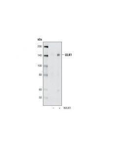 Cell Signaling Ulk1 (A705) Antibody