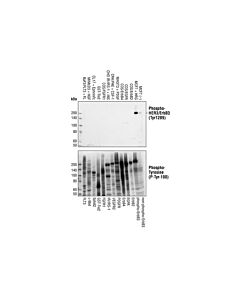 Cell Signaling Phospho-HER3/ErbB3 (Tyr1289) (21D3) Rabbit mAb