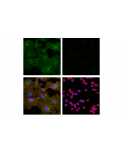 Cell Signaling Cd248 (E9z7o) Xp Rabbit mAb