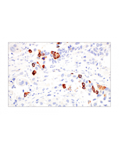 Cell Signaling Keratin 14 (Ll002) Mouse mAb