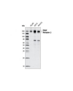 Cell Signaling Pdgf Receptor Beta (C82a3) Rabbit mAb (Bsa And Azide Free)