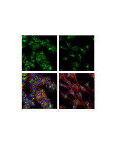 Cell Signaling Eea1 (E9q6g) Mouse mAb