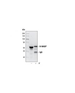 Cell Signaling N-Wasp (30d10) Rabbit mAb