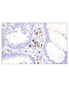 Cell Signaling Cd20 (E7b7t) Xp Rabbit mAb