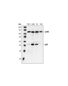 Cell Signaling Nf-Kappab2 P100/P52 Antibody