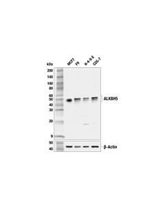 Cell Signaling ALKBH5 (E3F6E) Rabbit mAb