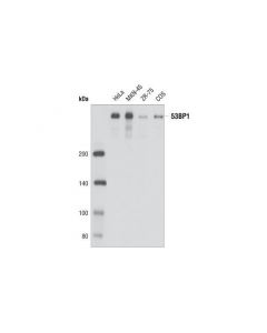 Cell Signaling 53bp1 (P550) Antibody