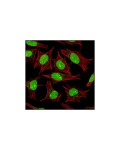 Cell Signaling Sumo-1 Antibody