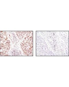 Cell Signaling Sumo-1 (C9h1) Rabbit mAb