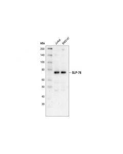 Cell Signaling Slp-76 Antibody
