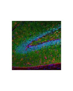 Cell Signaling Camkii-Alpha (6g9) Mouse mAb