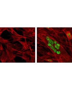 Cell Signaling Mef2c (D80c1) Xp Rabbit mAb