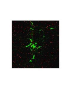 Cell Signaling Tph2 (D3e5i) Xp Rabbit mAb