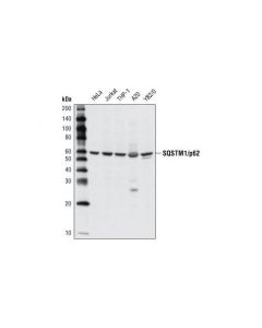 Cell Signaling Sqstm1/P62 Antibody