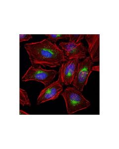 Cell Signaling Rab9a (D52g8) Xp Rabbit mAb