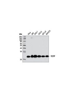 Cell Signaling Tctp (D10f2) Rabbit mAb