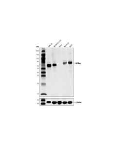 Cell Signaling N-Myc (D4B2Y) Rabbit mAb