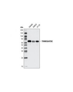 Cell Signaling Trim29/Atdc Antibody
