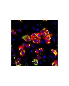 Cell Signaling Lipin 1 Antibody