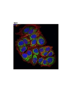 Cell Signaling Akap1 (D9c5) Xp Rabbit mAb