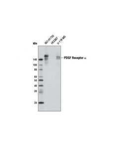 Cell Signaling Pdgf Receptor Alpha (D13c6) Xp Rabbit mAb (Biotinylated)