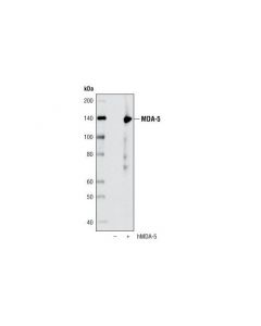 Cell Signaling Mda-5 (D74e4) Rabbit mAb