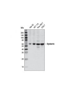 Cell Signaling Dyskerin (D6n4k) Rabbit mAb
