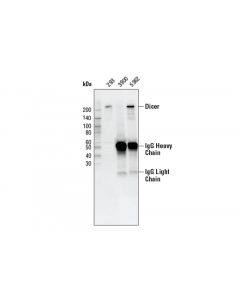 Cell Signaling Dicer (D38e7) Rabbit mAb